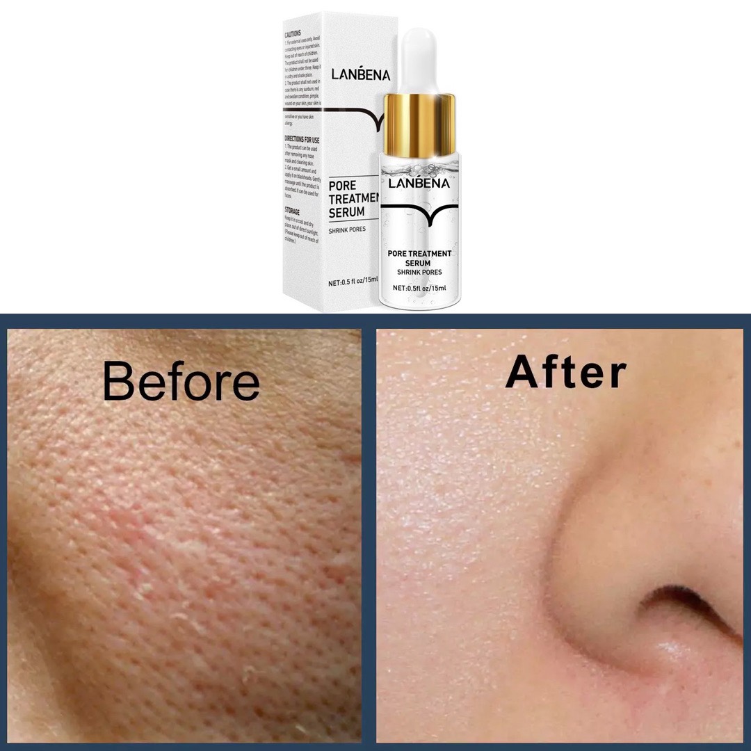 سرم تخصصی کوچک کننده منافذ باز لانبنا