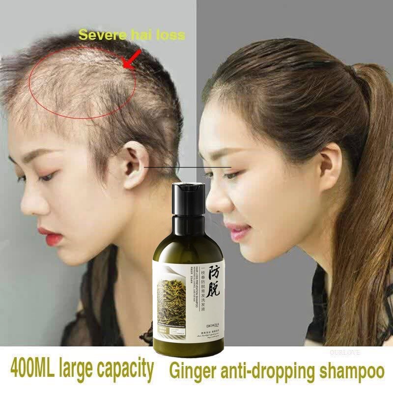 شامپو ضد ریزش بیوآکوا اورجینال