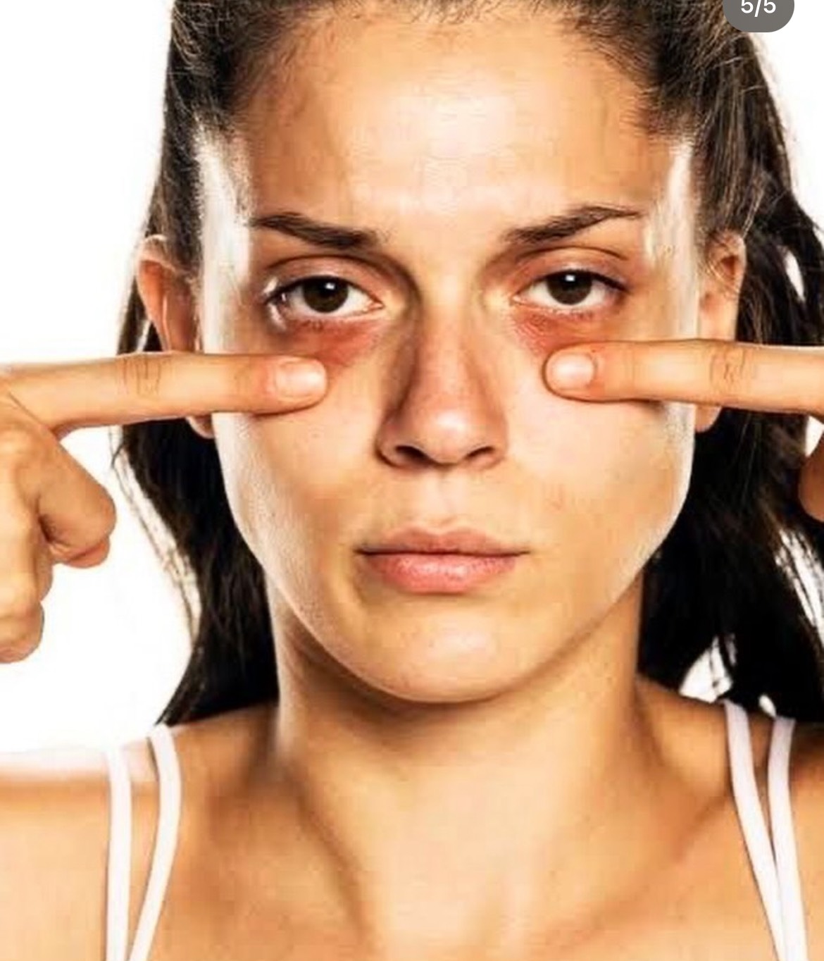 کرم دورچشم گارنیر