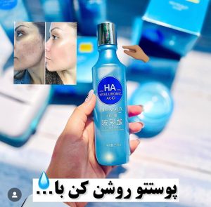 تونر HA هیالورونیک