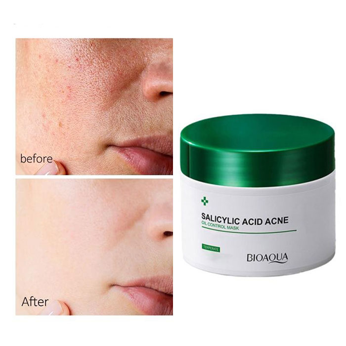 ماسک سالسیلیک اسید بیواکوا