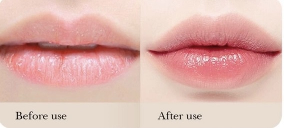 بالم لب موزی