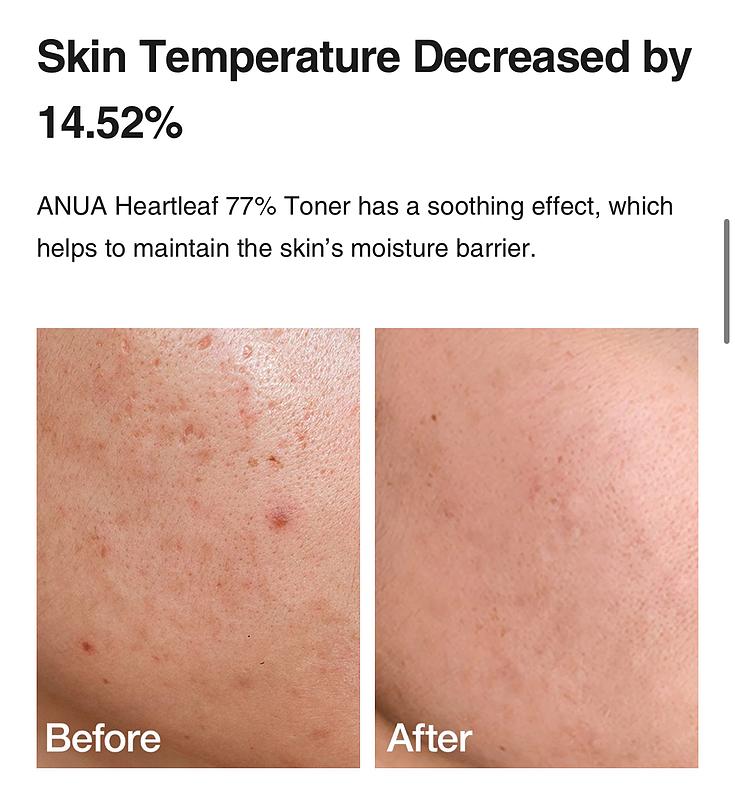 تونر انوا ۷۷ درصد Heartleaf