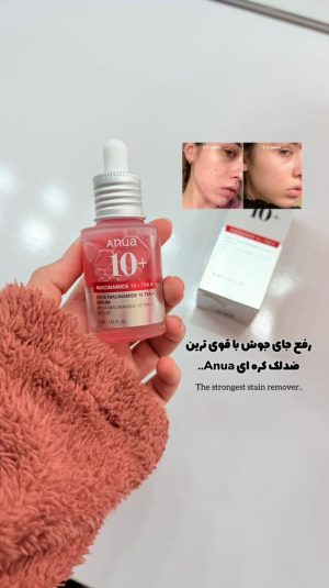 سرم ضدلک نیاسینامید اورجینال انوا Anua
